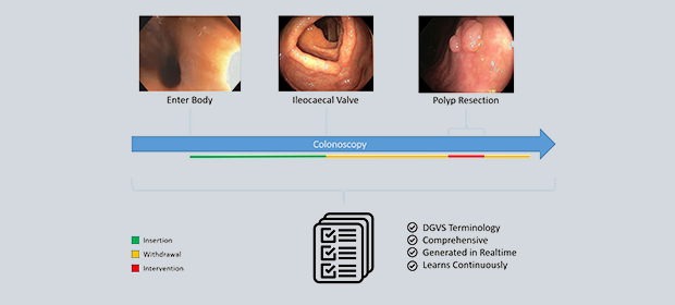 EndoAssist Graphic