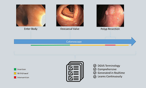 Visual of Endo-Assist