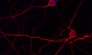 Sensorische Nervenzellen in Zellkultur