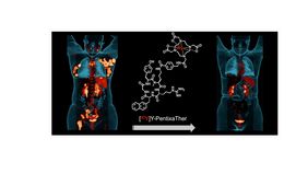 Die Collage zeigt links die Chemokinrezeptor-Bildgebung bei der die T-Zell-Lymphome leuchten. Rechts ist das Ergebnis nach einer einmaligen Therapie mit Yttrium-90-CXCR4-Liganden zu sehen: Das Lymphom konnte komplett beseitigt werden.