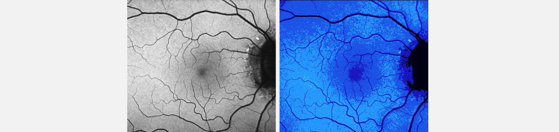 Illustrationsfoto Retinaforschung