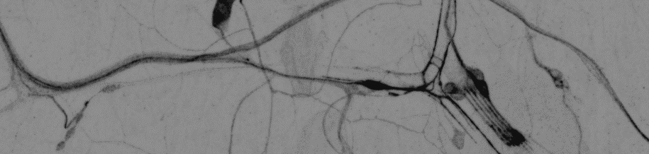 Aufnahme von senorischen Neuronen