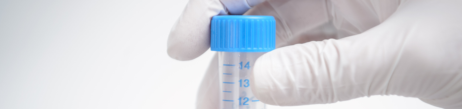 Laborprobe Illustrationsbild: Laborproben