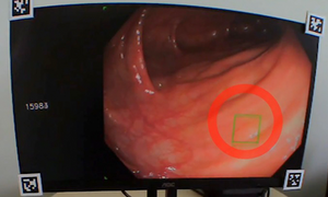 Image of Eye Tracking