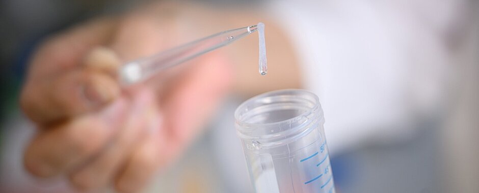 DNA DNA-Extraktion - Durch die Ansäuerung ist ein weißer Faden entstanden