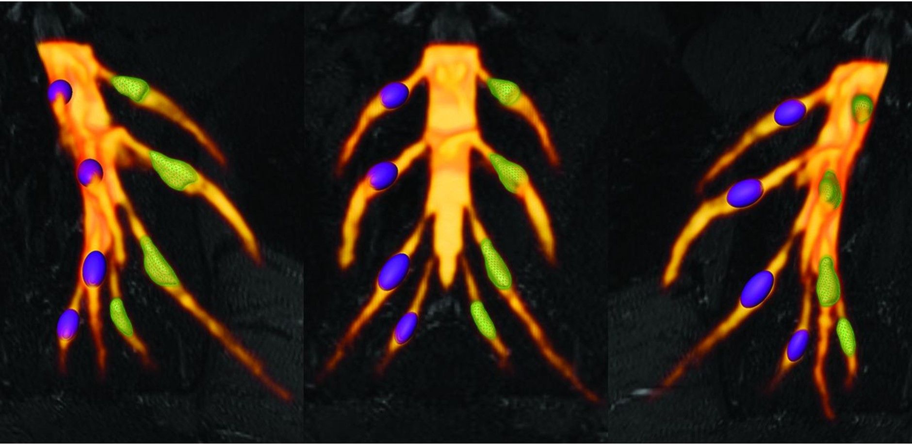 Foto der lumbosakralen Spinalganglien