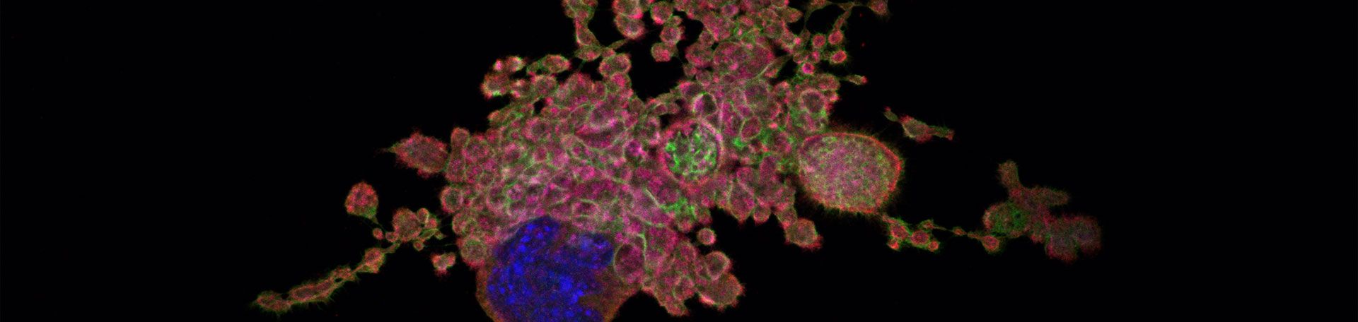 Illustrationsbild: Ein Megakaryozyt bildet proplatelets in Kultur. Filamentöses Aktin ist in rot und Tubulin in türkis dargestellt.