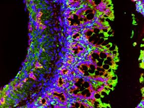 Das Bild zeigt eine mikroskopische Aufnahmen von immunfluoreszenzgefärbten Zellen eines Mausdarms.