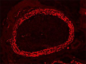 Bild von Immunhistochemie des Nervus suralis mit Expression von Claudin-1 (rot) im Perineurium 