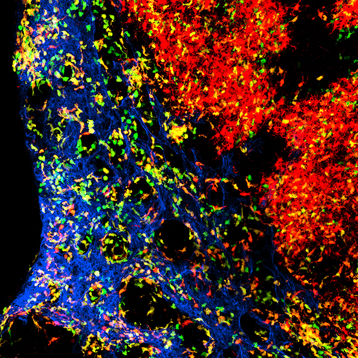 Die Abbildung zeigt die komplexe Organisation von dendritischen Zellen im Lymphknoten. 