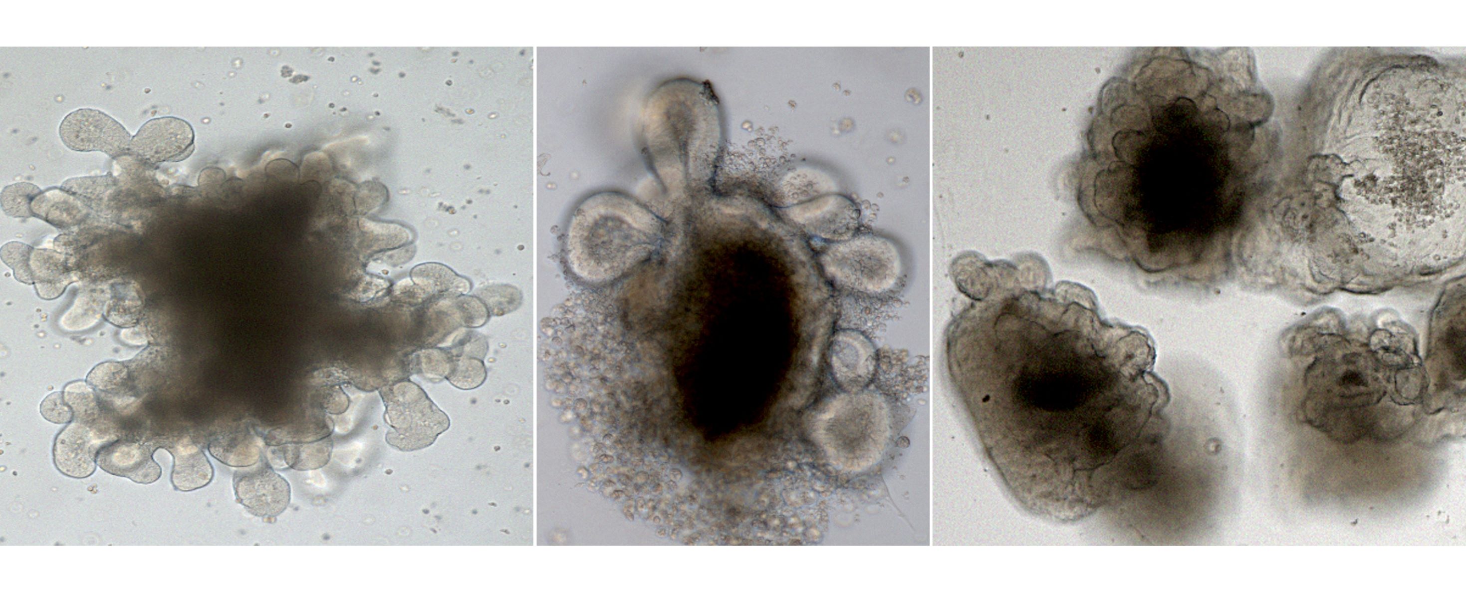Collage aus drei mikroskopischen Bildern von Organoiden.