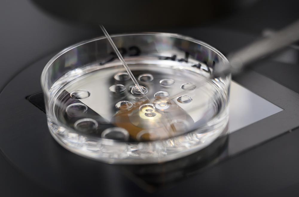 Eine Petrischale mit Spermien und Eizellen in einer Flüssigkeit steht auf Mikroskoptisch.