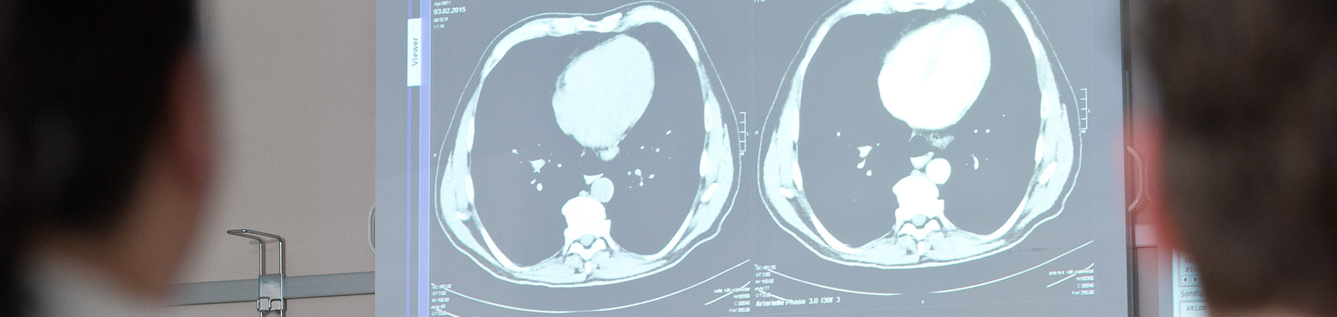 Illustrationsbild Ärztliche Behandlung: Eine Aufnahme eines Tumors auf einem Monitor